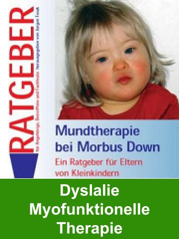 Dyslalie, Myofunktionelle Therapie