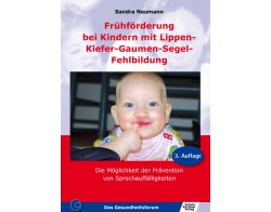 LKGS Lippen-Kiefer-Gaumen-Segel-Fehlbildung